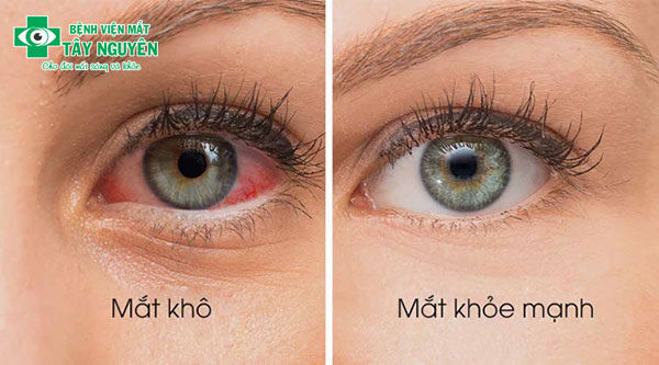 8 dấu hiệu cần đi khám mắt