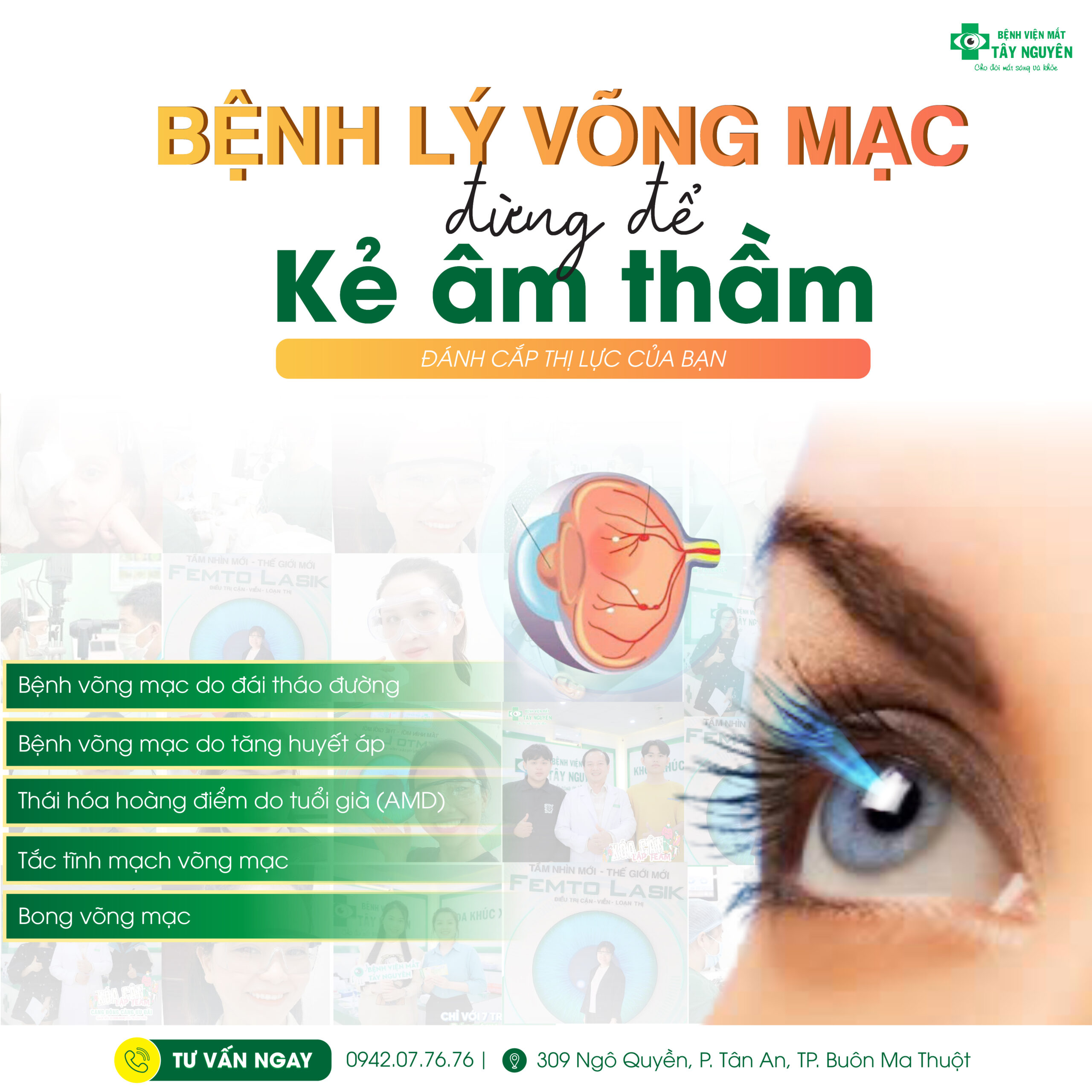 Bong võng mạc là gì?