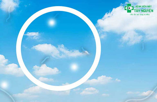 Hình ảnh võng mạc của bạn có thể gặp nguy hiểm