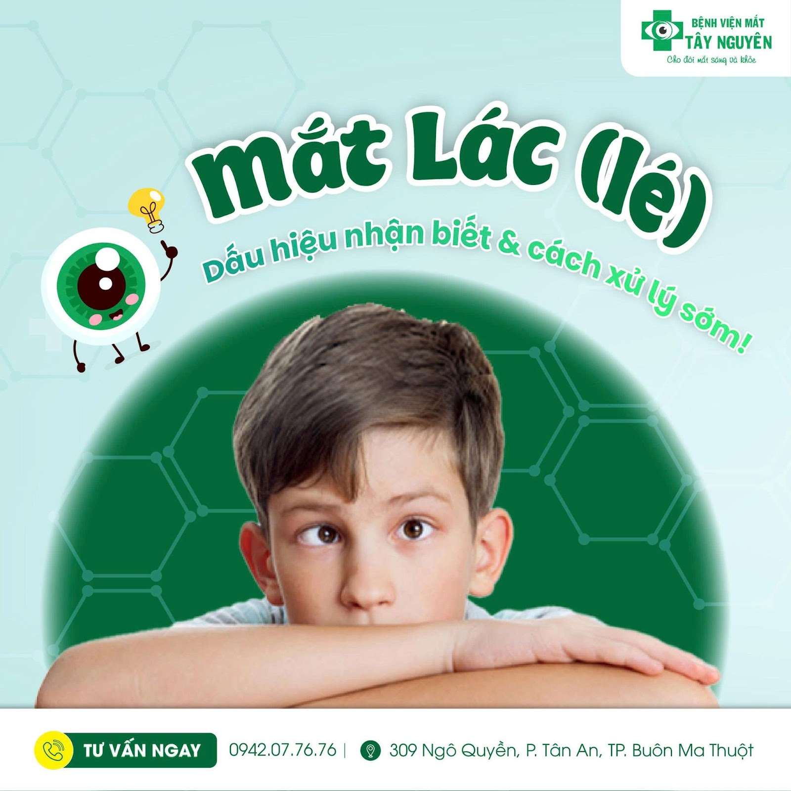 Mắt lác (lé) có thể xuất hiện ở cả trẻ em lẫn người lớn.